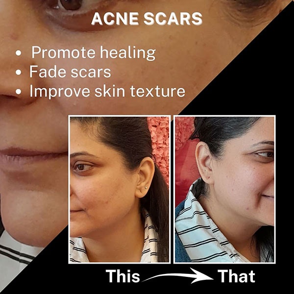 House of Beauty Bright Skin Serum For Everyday Use with Hyaluronic, Niacin, Arbutin &Vit- C 30ml