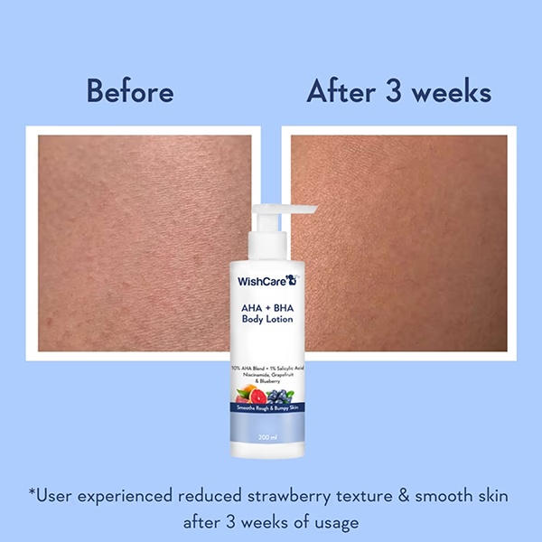 1617-wishcare-10-aha-1-bha-body-lotion-smooths-rough-amp-bumpy-skin-with-niacinamiderapefruit-amp-blueberry-200-ml-1.jpg