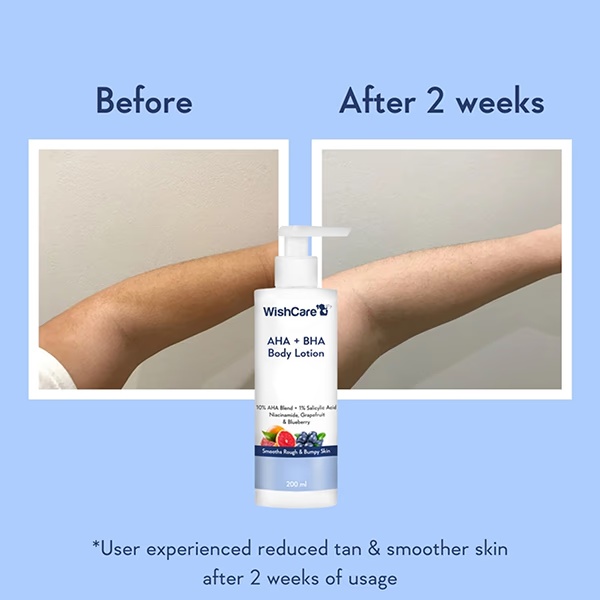 1617-wishcare-10-aha-1-bha-body-lotion-smooths-rough-amp-bumpy-skin-with-niacinamiderapefruit-amp-blueberry-200-ml-1.jpg