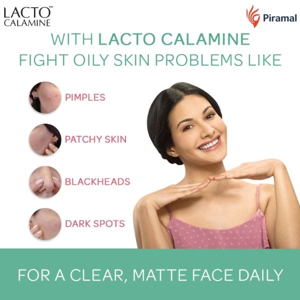 2746-lacto-calamine-oil-balance-combination-to-normal-skin-lotion-30-ml-1.jpg