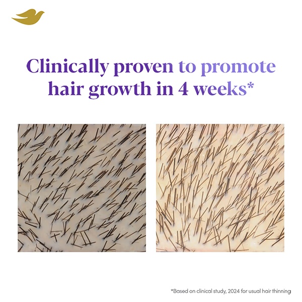 3215-dove-scalp-hair-therapy-density-boost-revitalizing-scalp-serum-50-ml-1.jpg