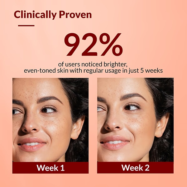 44-fixderma-2-kojic-acid-1-arbutin-skarfix-plus-scar-removal-cream-30-gm-1.jpg
