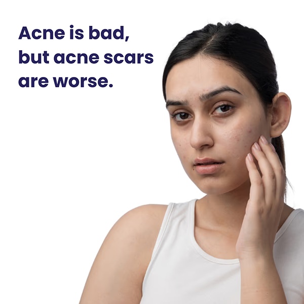 Reequil Pitstop Blue Niacinamide Serum For Acne Scars & Marks 25 ml