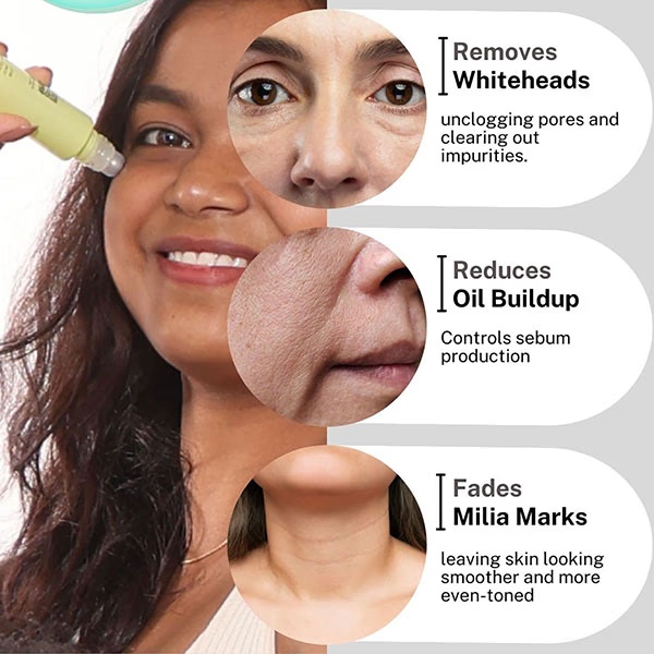4986-house-of-beauty-milia-serum-for-white-cysts-black-amp-whiteheads-open-pores-with-azelaic-15ml-1.jpg
