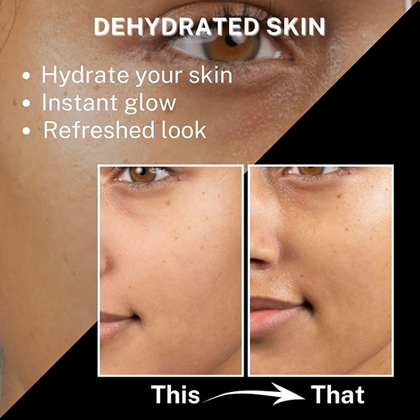 House of Beauty Tea Tree+Avocado Toner-Oily, Combination & Sensitive & Acne Prone Skin 100ml
