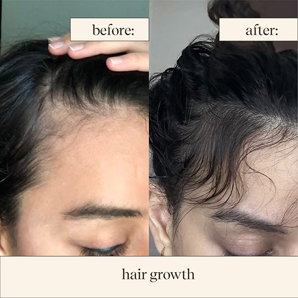 7004-inde-wild-1-bakuchiol-serum-with-squalane-to-restore-skin-barrier-and-firmness-and-even-out-skin-tone-10-ml-1.jpg