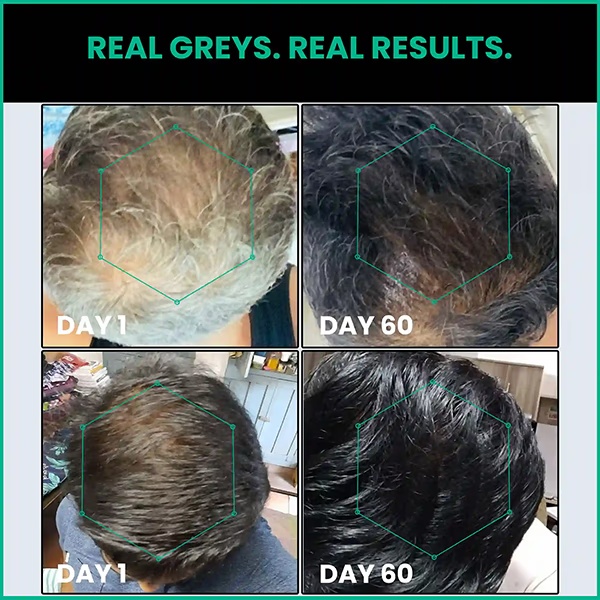 7372-thriveco-anti-greying-hair-prime-serum-reverses-premature-greying-50-ml-1.jpg