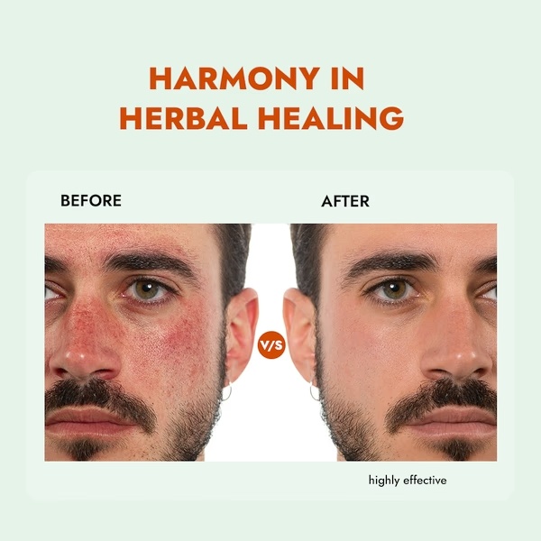 7580-alziba-cares-face-wash-herbal-care-100-ml-1.jpg