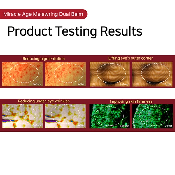 8224-thank-you-farmer-miracle-age-melawring-dual-balm-10-gm-1.jpg