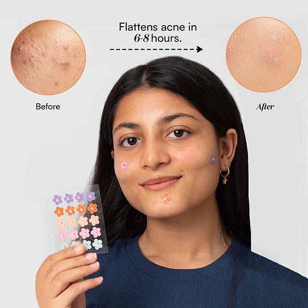 Gush Beauty Dart It Hydrocolloid Pimple Patches For Healing Acne, Zits And Blemishes - Holographic Butterfly 1's